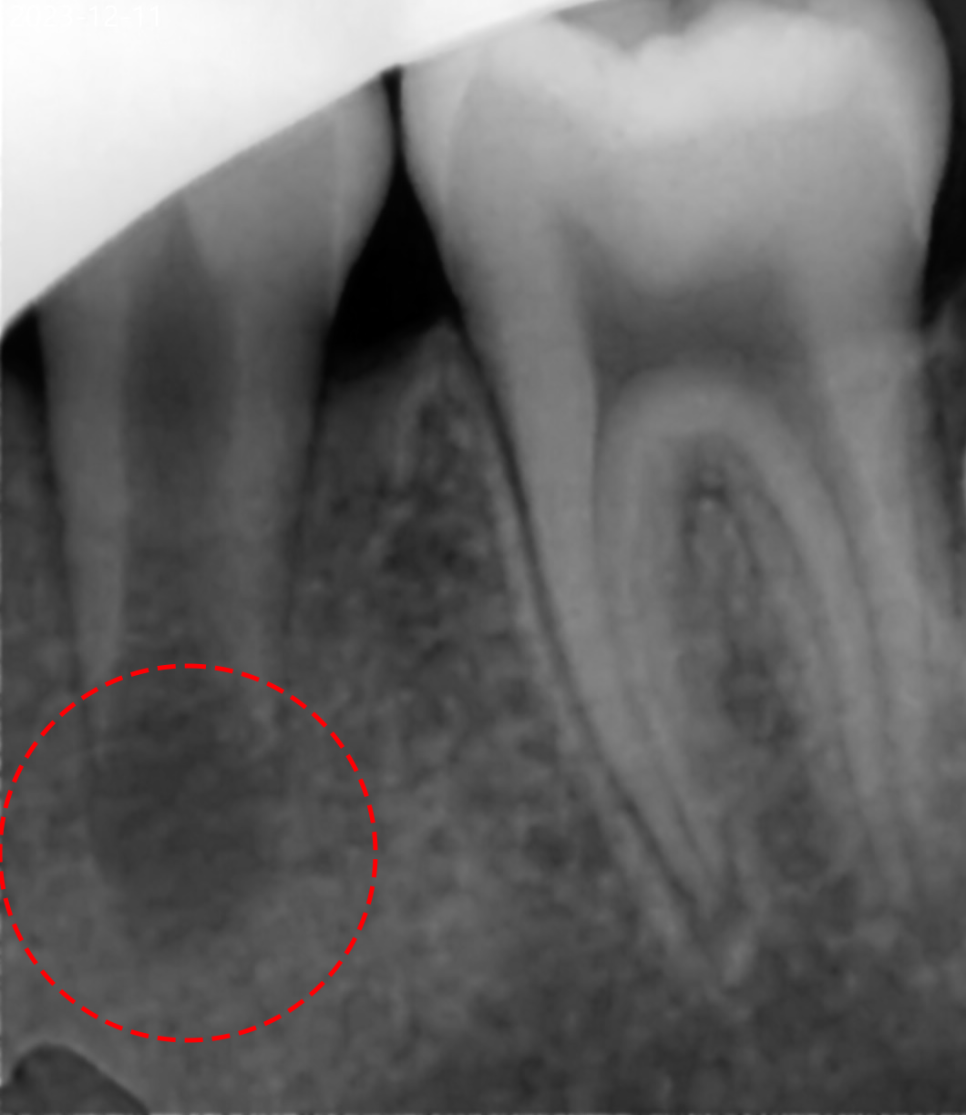 Treatment case image 3