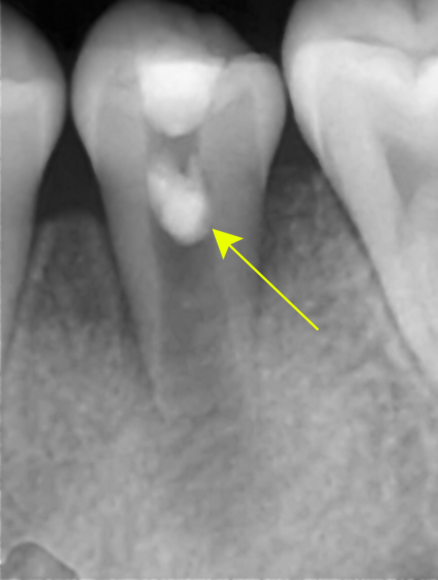 Treatment case image 4
