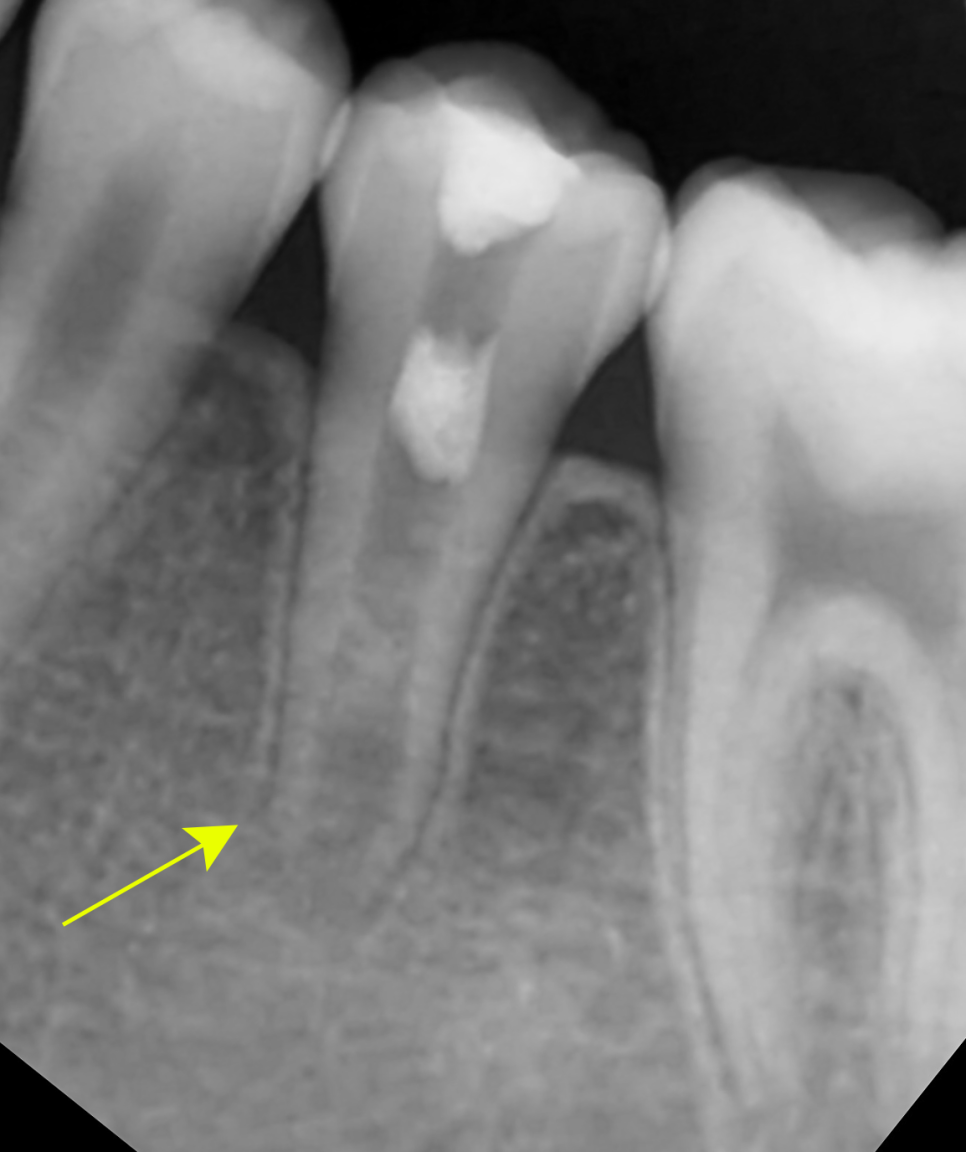 Treatment case image 5