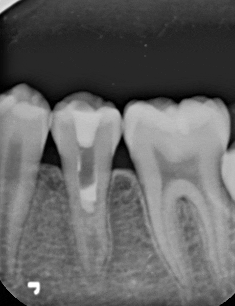 Treatment case image 6
