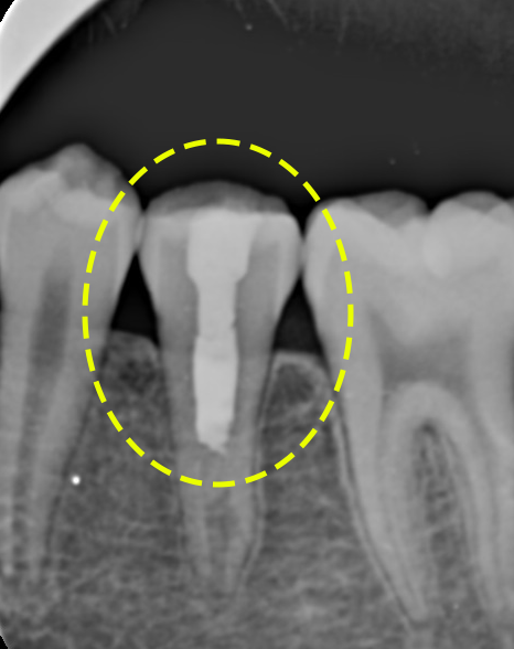 Treatment case image 7