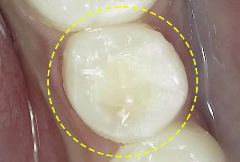 Treatment case image 8