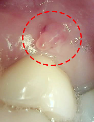 Treatment case image 1