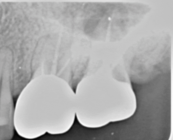 Treatment case image 2