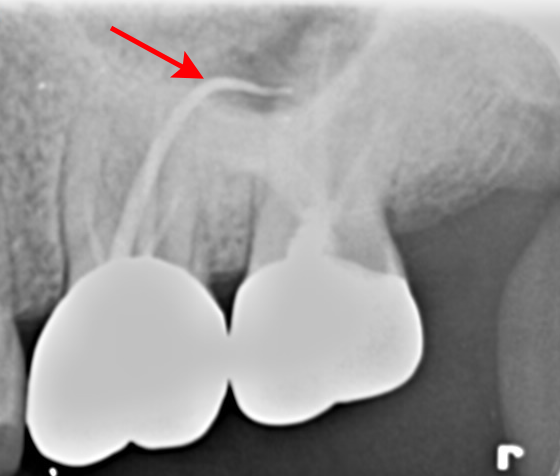Treatment case image 3
