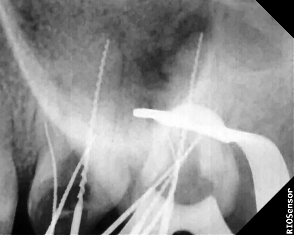 Treatment case image 7
