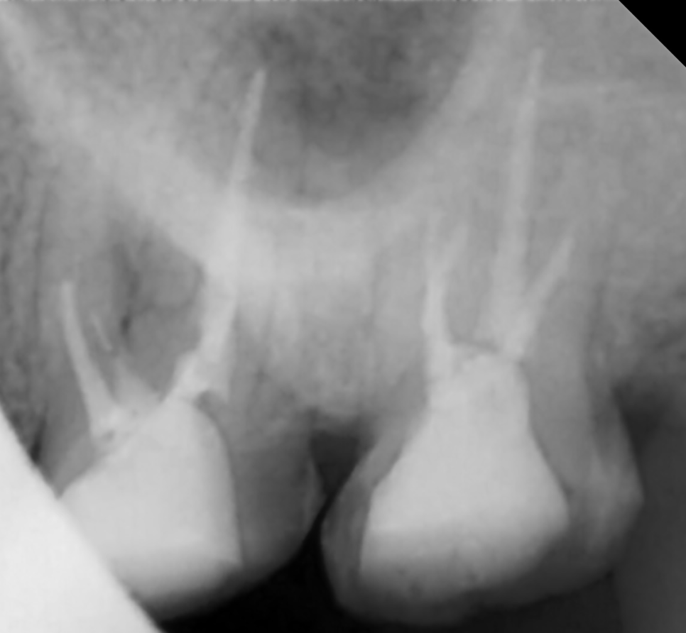 Treatment case image 9
