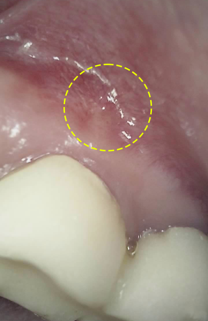 Treatment case image 10