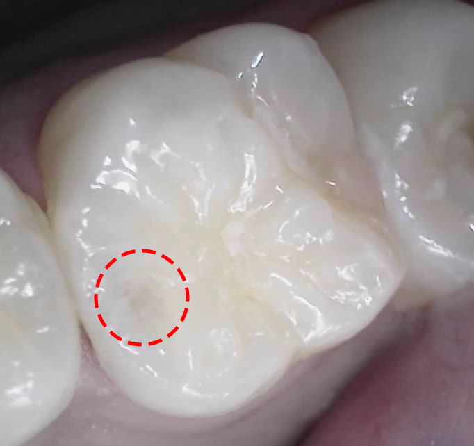 Treatment case image 1