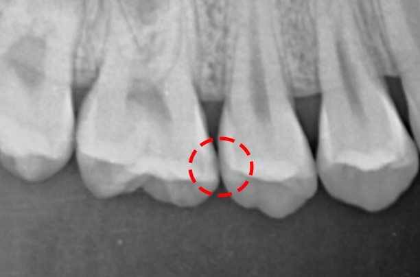 Treatment case image 2
