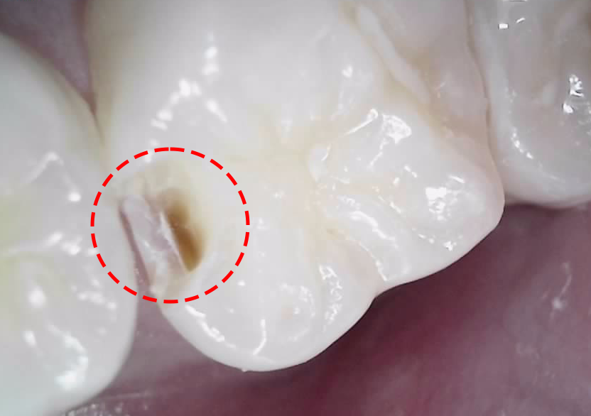 Treatment case image 5