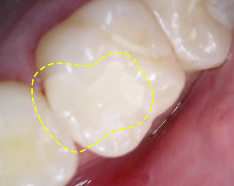 Treatment case image 6