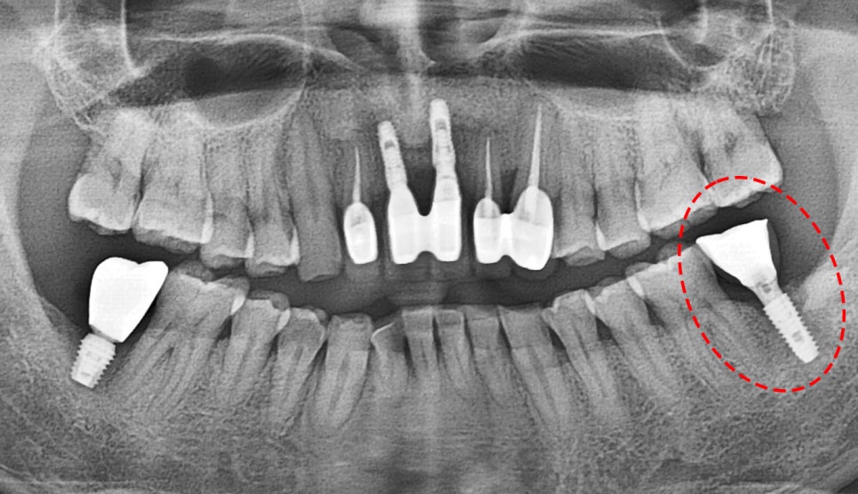 Treatment case image 1