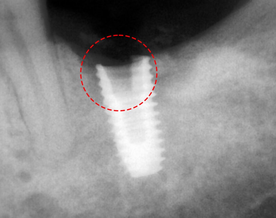 Treatment case image 2