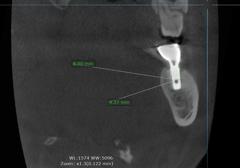 Treatment case image 5