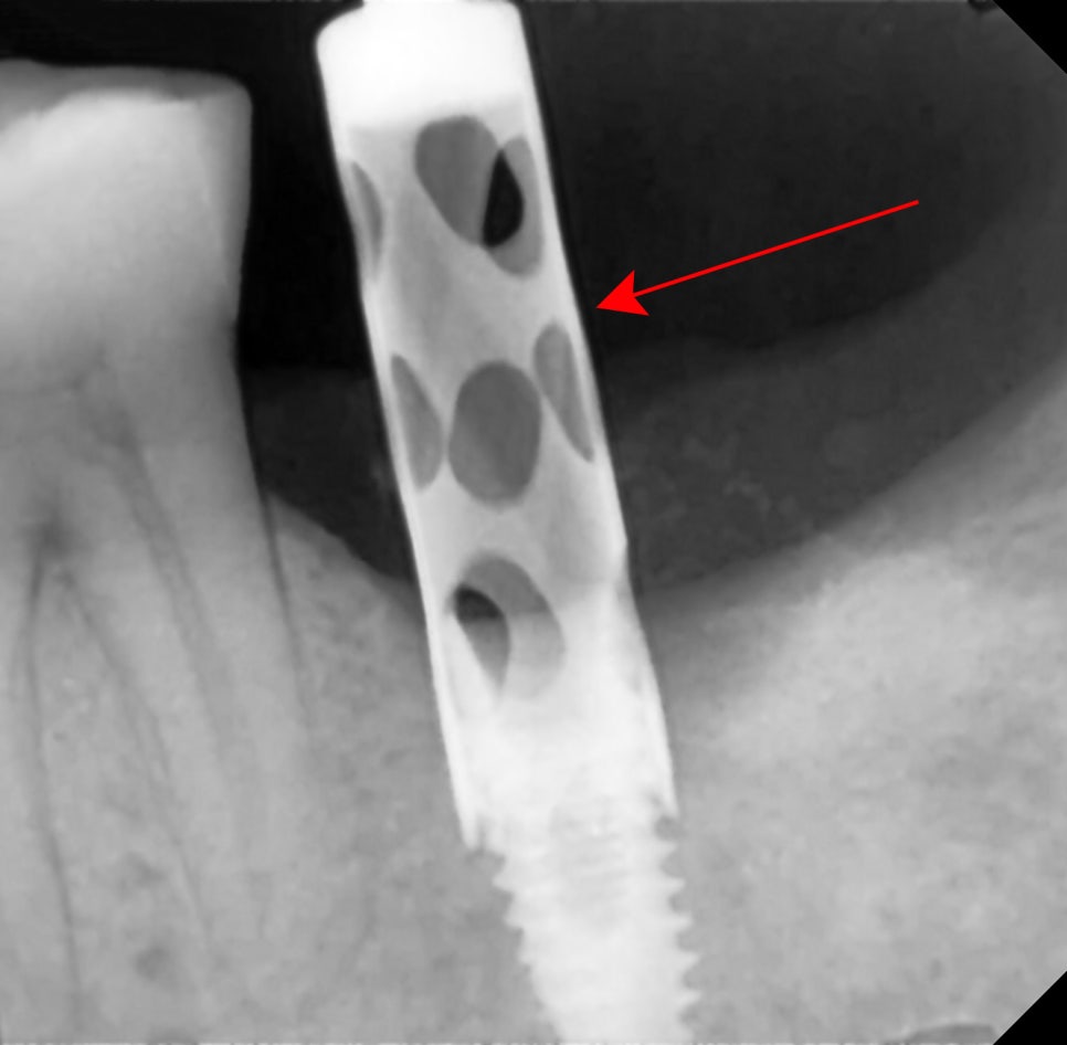 Treatment case image 6