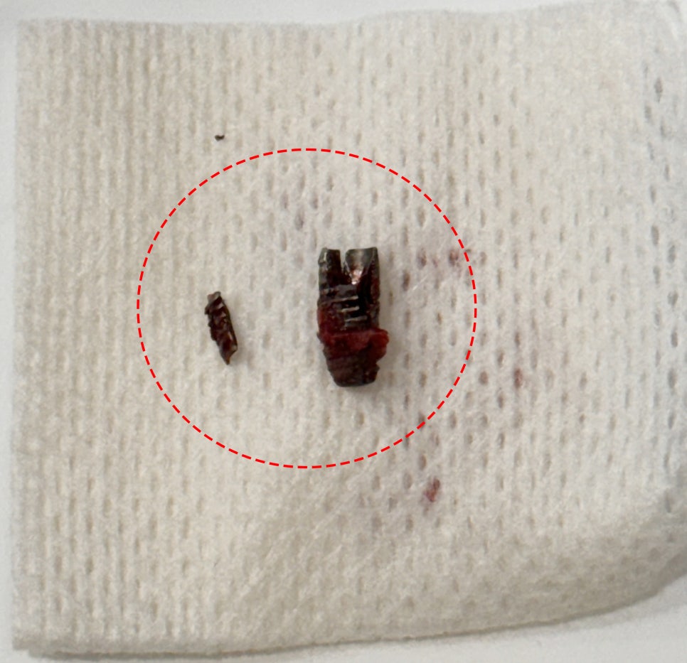 Treatment case image 7