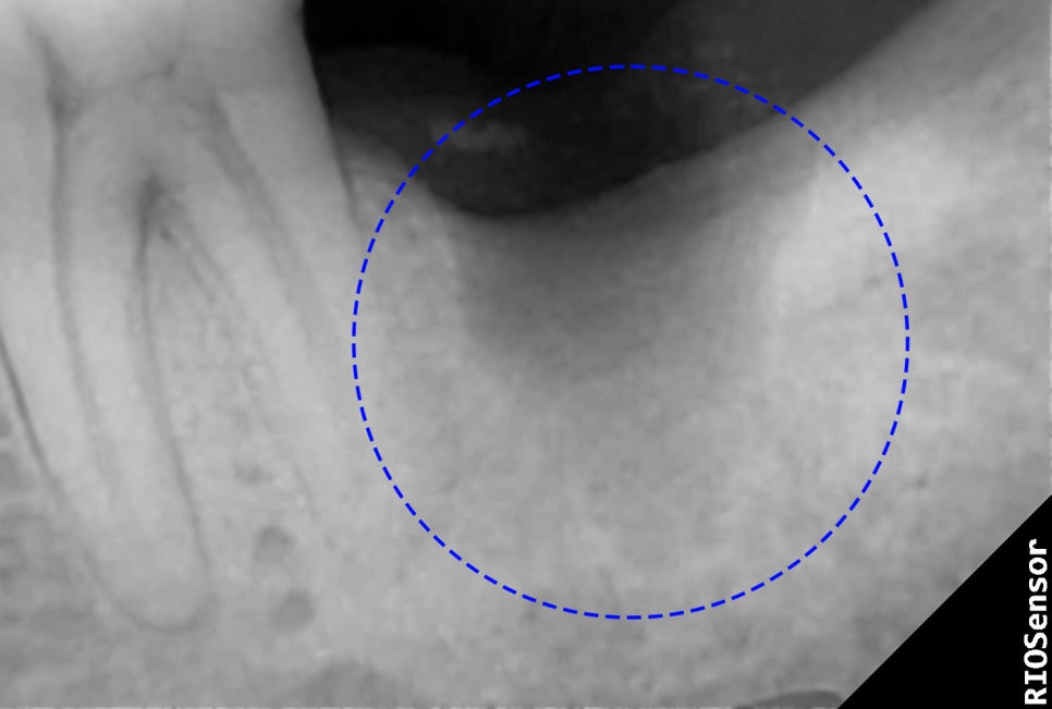 Treatment case image 8