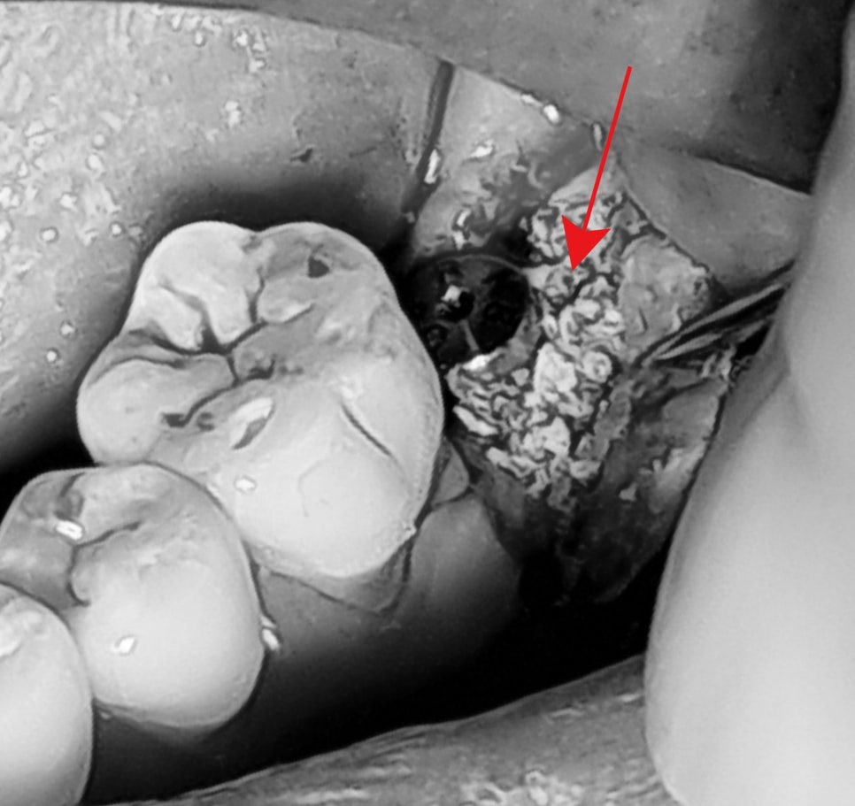 Treatment case image 9