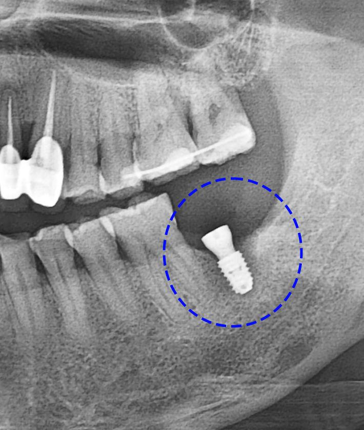 Treatment case image 10