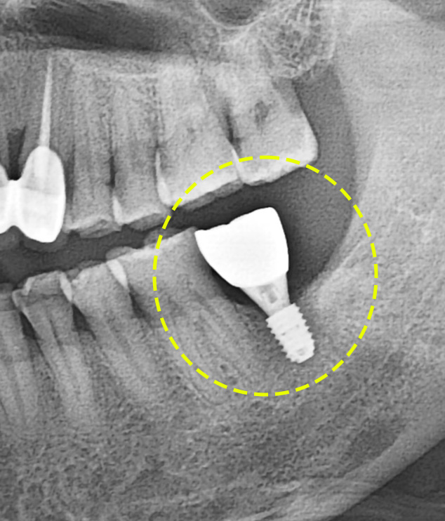 Treatment case image 13