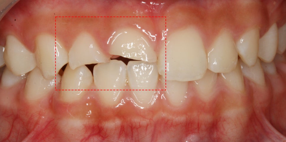 Treatment case image 1