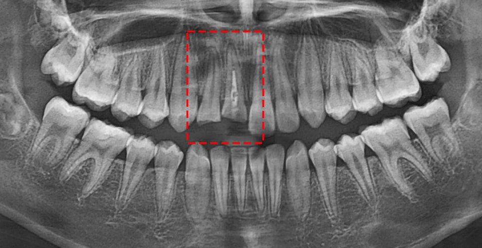 Treatment case image 2