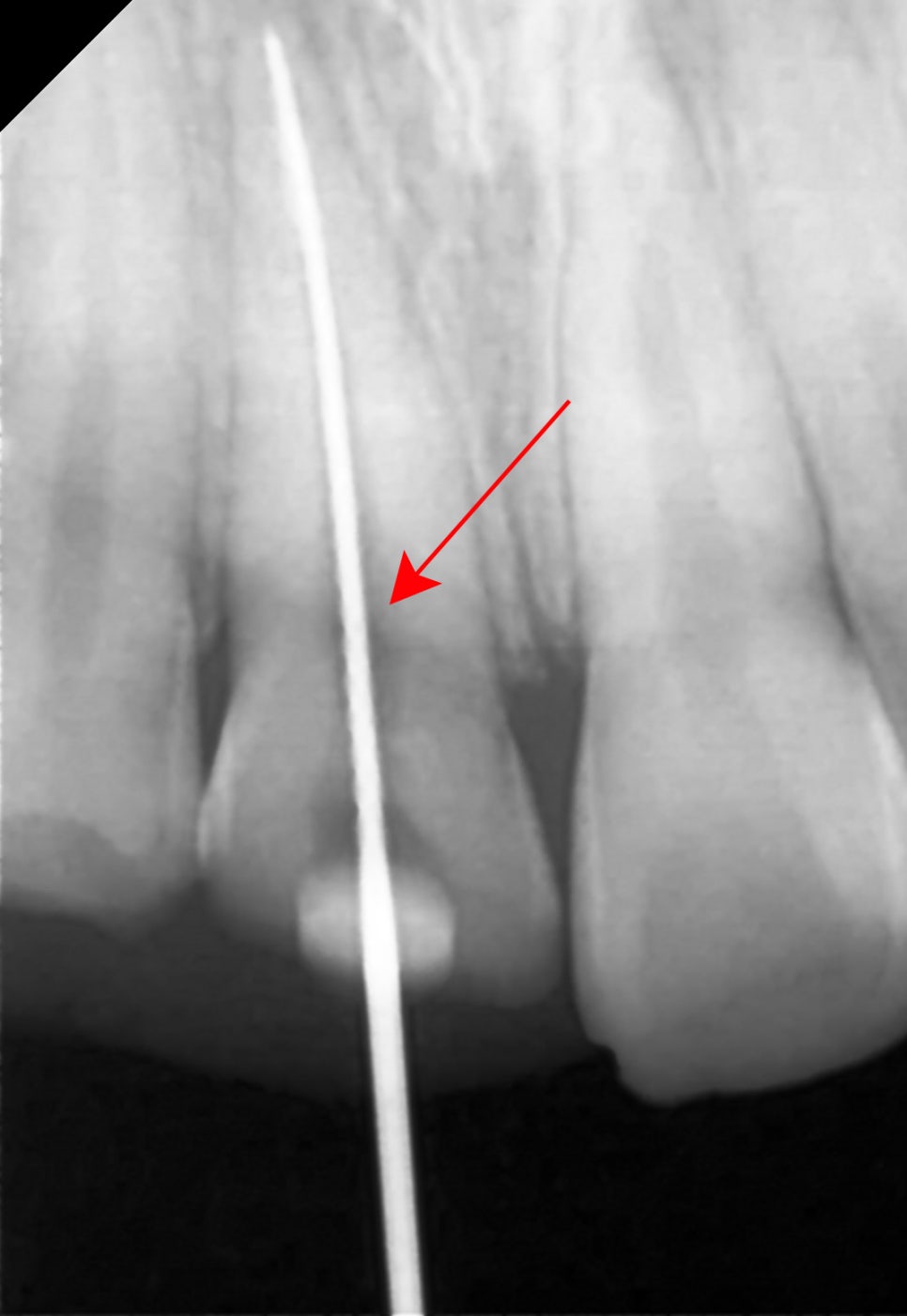 Treatment case image 5