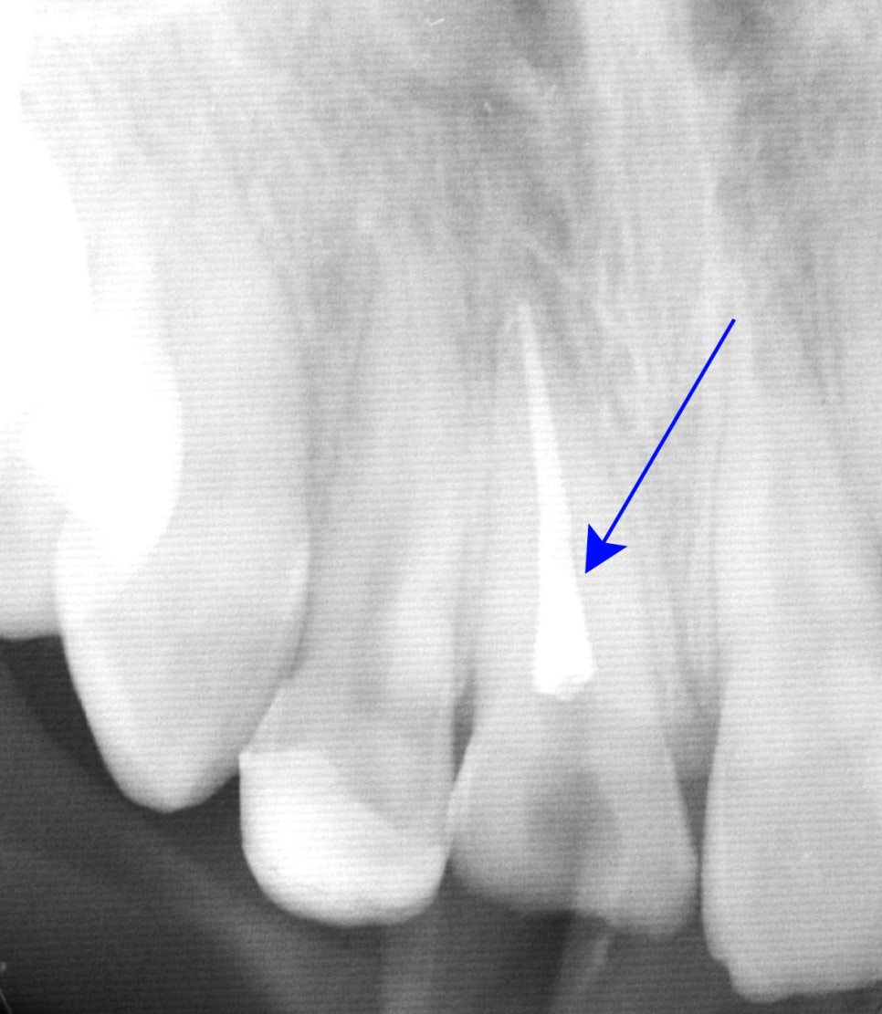 Treatment case image 6