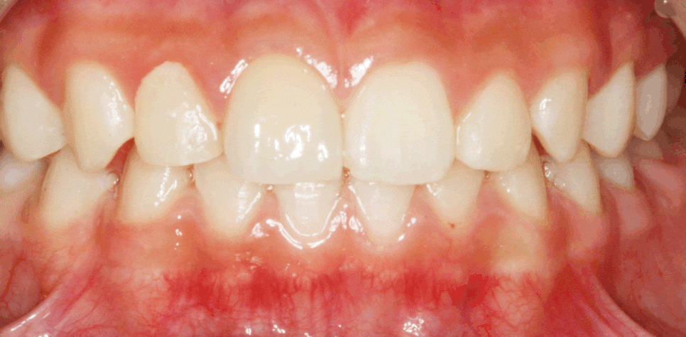 Treatment case image 7