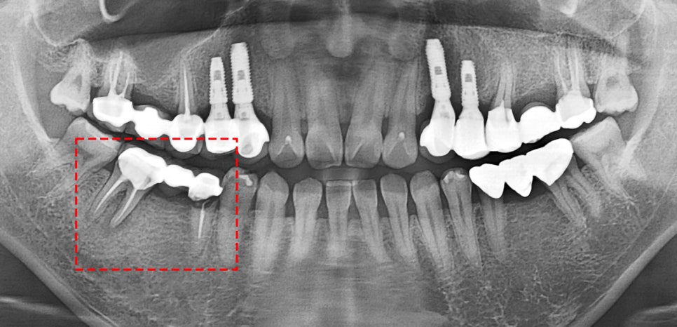 Treatment case image 1