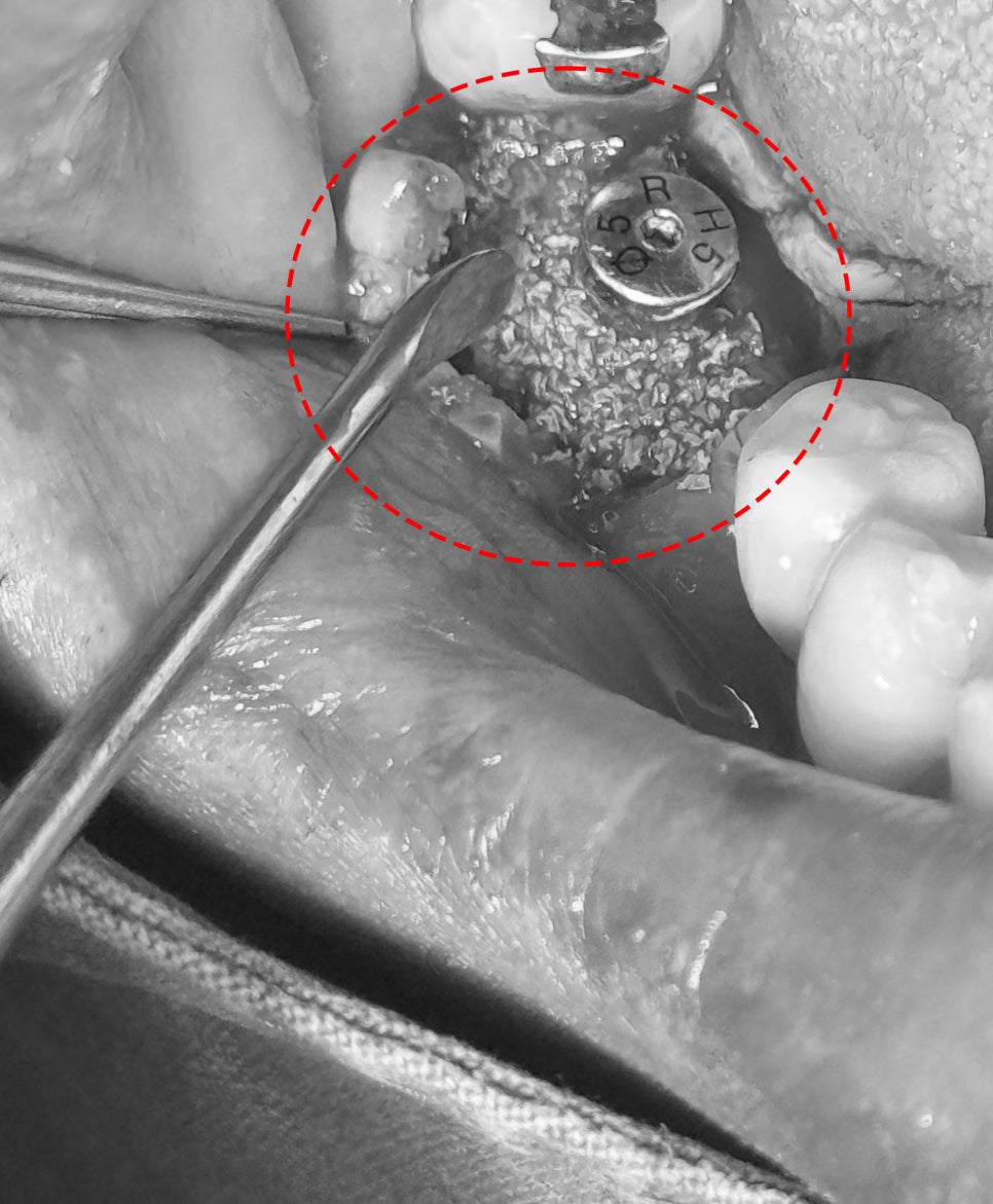 Treatment case image 2