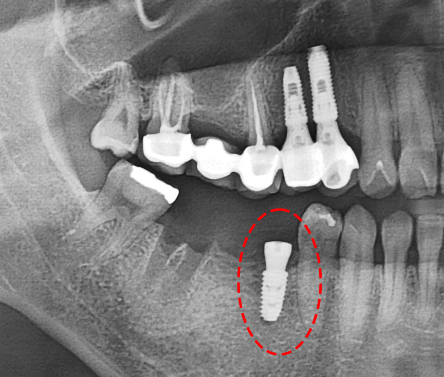 Treatment case image 3