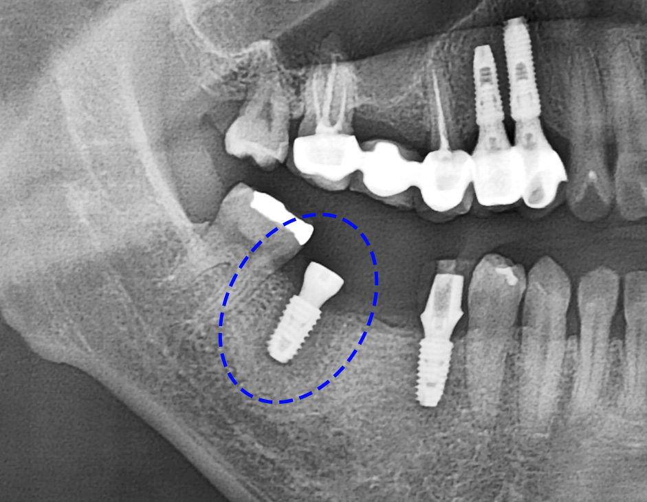 Treatment case image 6