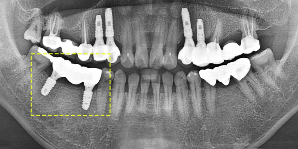 Treatment case image 7
