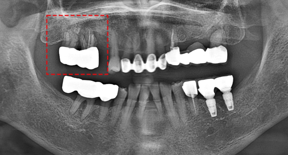 Treatment case image 1