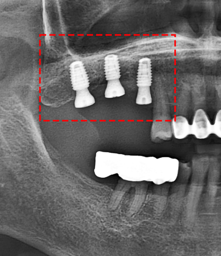 Treatment case image 2