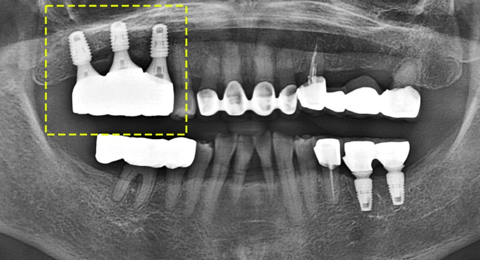 Treatment case image 3