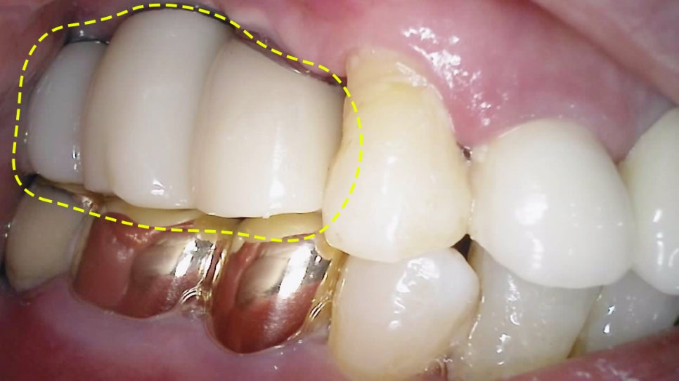 Treatment case image 4