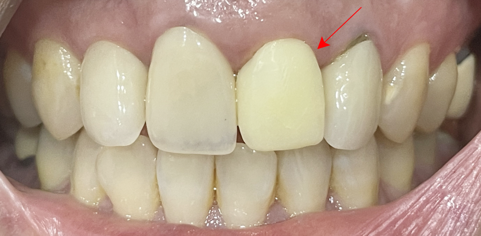 Treatment case image 1