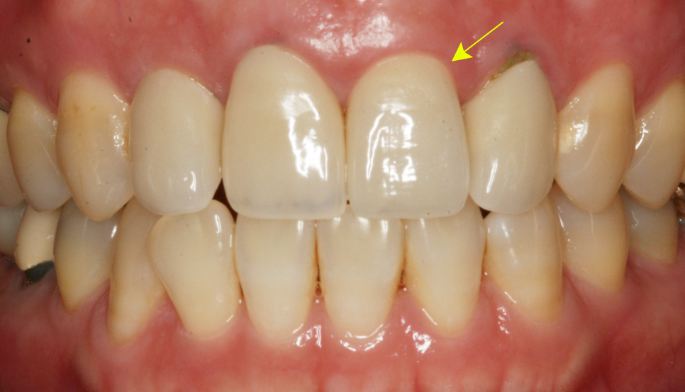 Treatment case image 3