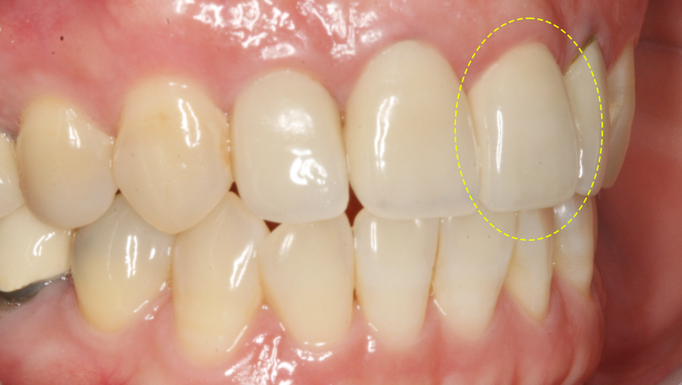 Treatment case image 4