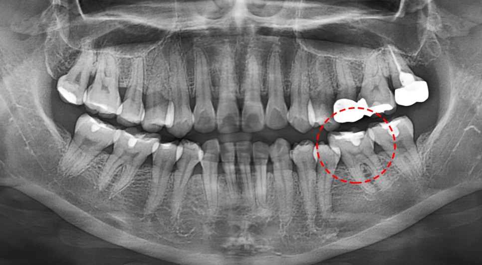 Treatment case image 1