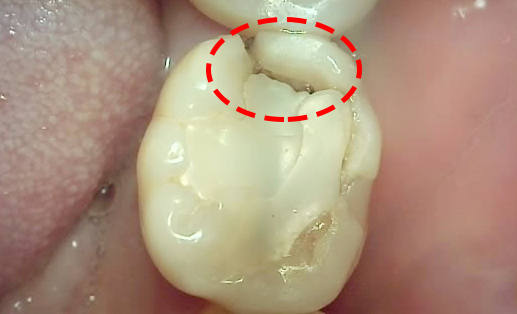 Treatment case image 2