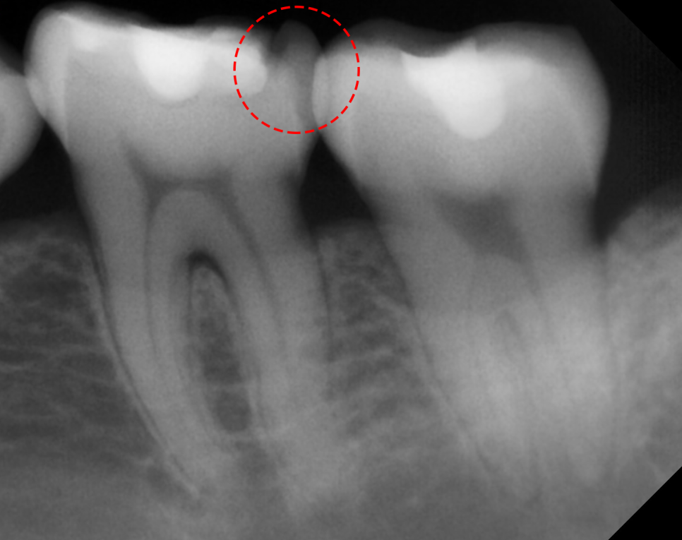 Treatment case image 3