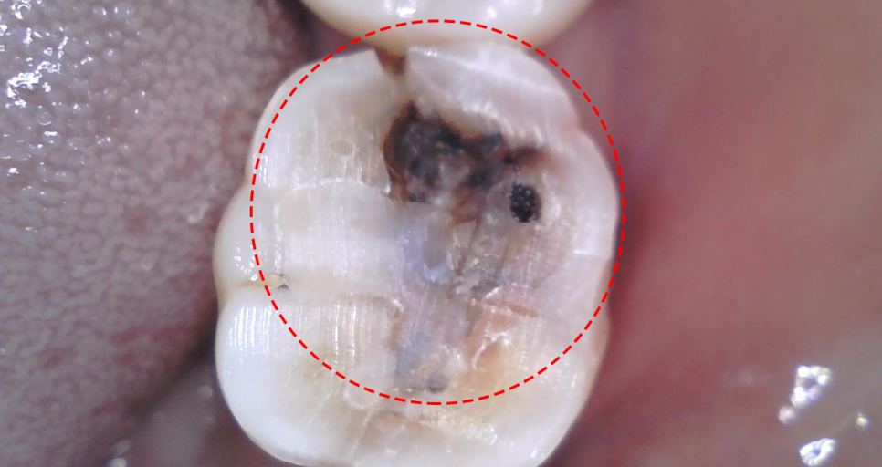 Treatment case image 6