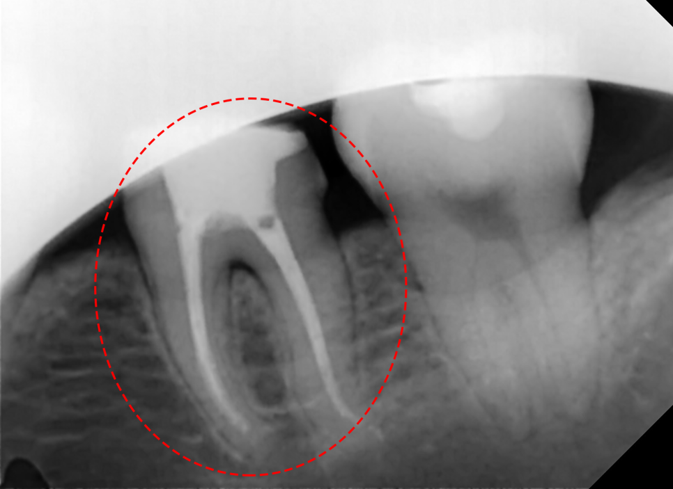 Treatment case image 7