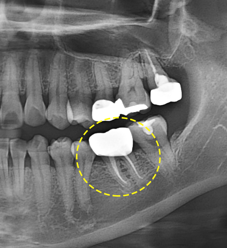 Treatment case image 10