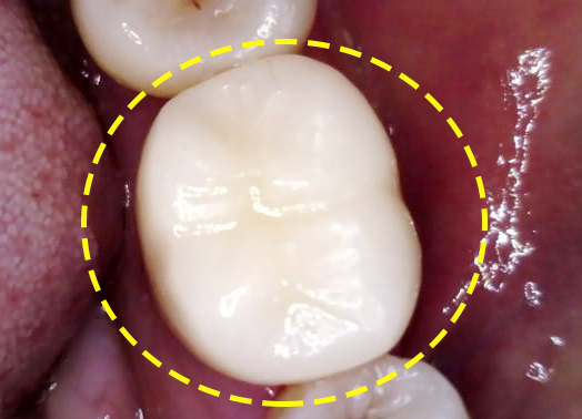 Treatment case image 11