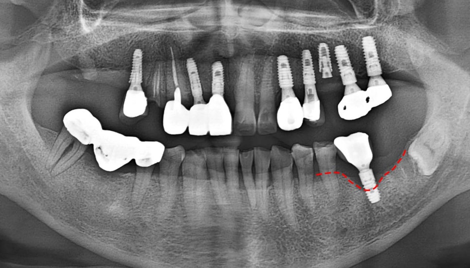 Treatment case image 1
